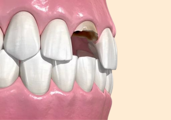 Emergency Dental Care